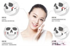 磨骨和削骨有什么區(qū)別?哪個(gè)風(fēng)險(xiǎn)大?