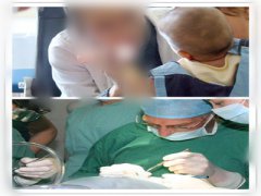 兔唇修復(fù)術(shù)_兔唇能完全修復(fù)嗎？