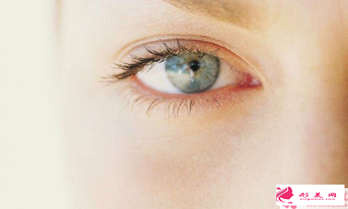 做雙眼皮-雙眼皮的注意事項(xiàng)有哪些？