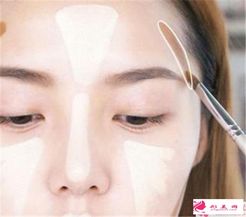剛填充額頭需要注意些什么_額頭填充注意事項