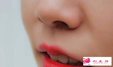 鼻翼縮小價(jià)錢是多少