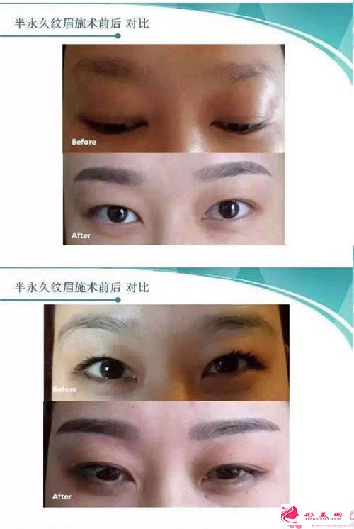 紋眉的過程_韓式半永久紋眉的過程是怎么樣的