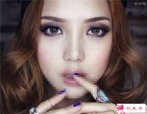 做植發(fā)整形術(shù)之后毛發(fā)多久長(zhǎng)出出來(lái)