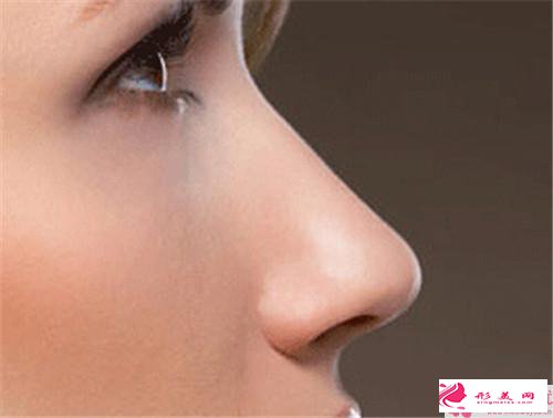 瑞藍(lán)隆鼻最佳效果要多久
