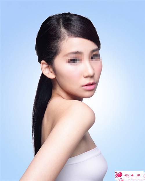 瑞藍(lán)隆鼻最佳效果要多久