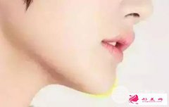 下巴整形價格是多少？