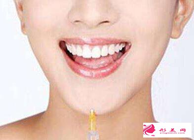 玻尿酸豐下巴被吸收了可以補打嗎