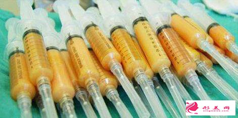 自體脂肪填充面部有害嗎