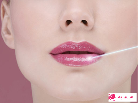 光子嫩膚是怎么樣的