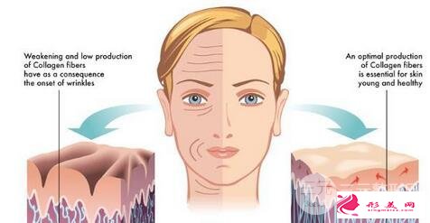 超音波拉皮的價(jià)格是多少 沒人告訴你的三件事
