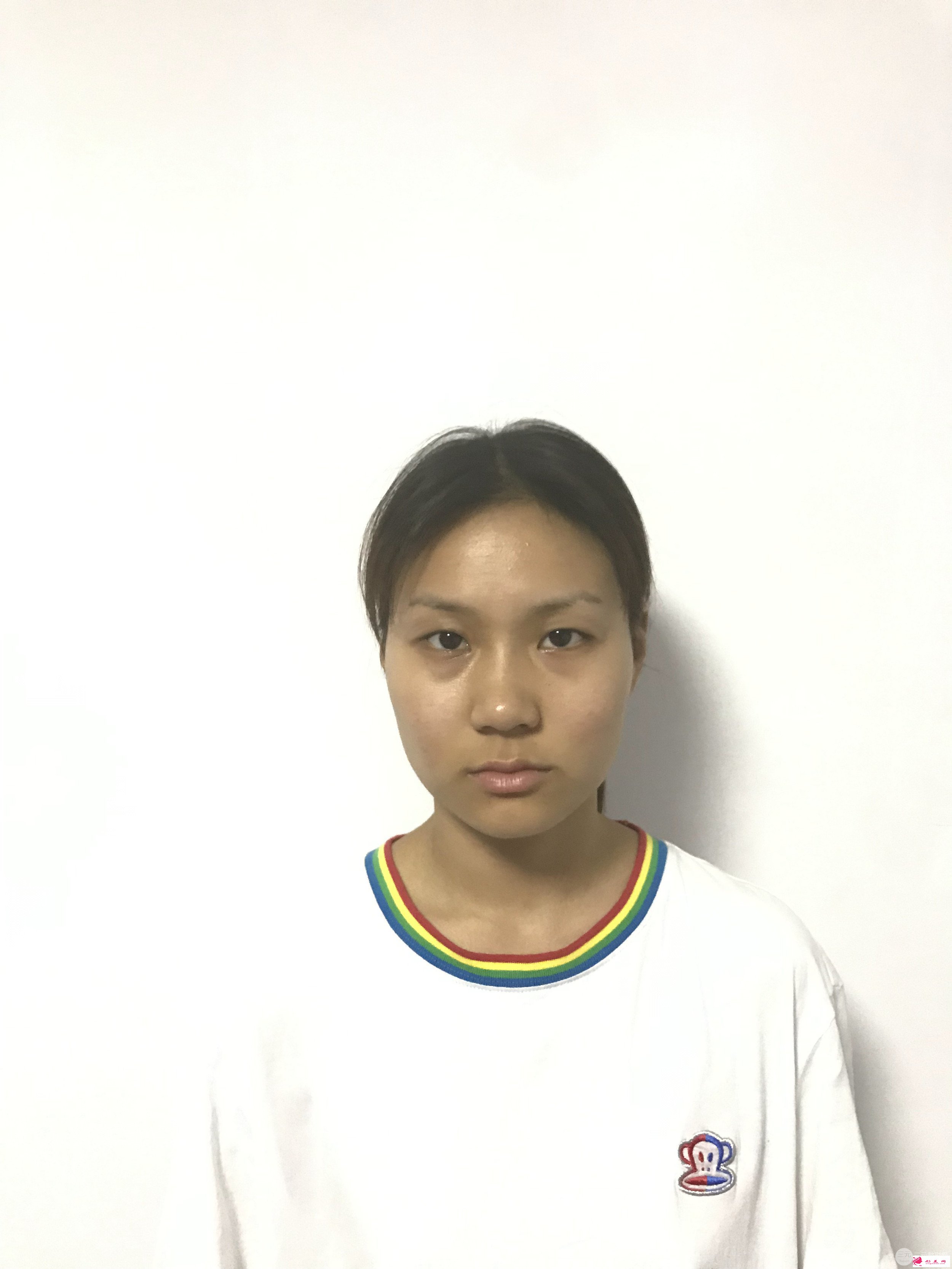 杭州浙一醫(yī)院整形科