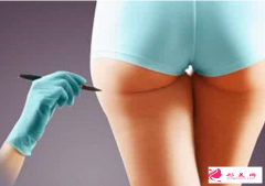什么人不適合做臀部吸脂