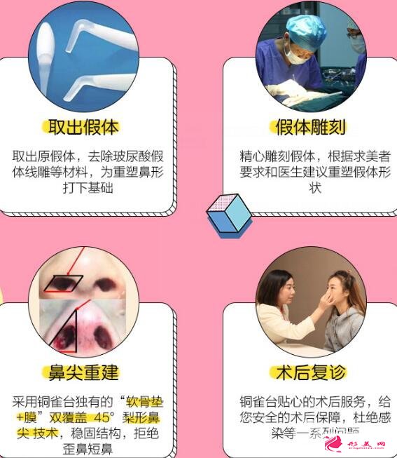 隆鼻失敗怎么辦？鼻修復(fù)手術(shù)過程