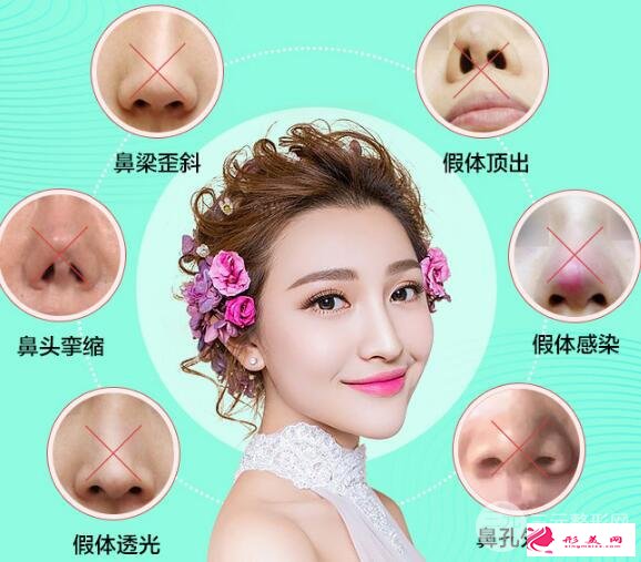 隆鼻失敗怎么辦？鼻修復(fù)手術(shù)是怎么做的？