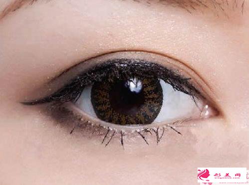 做三點(diǎn)雙眼皮效果好嗎