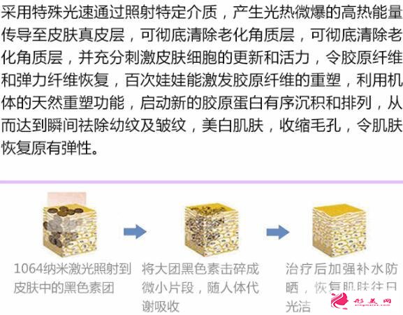 醫(yī)美小課堂：白瓷娃娃激光功效及效果圖