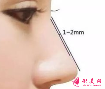 做自體軟骨隆鼻要多少錢