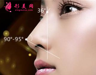 假體隆鼻效果能保持多少年