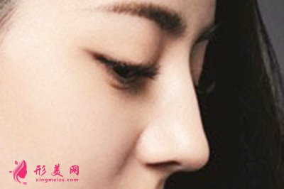 自體軟骨隆鼻有什么缺點(diǎn)