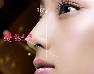 自體軟骨隆鼻有什么缺點(diǎn)