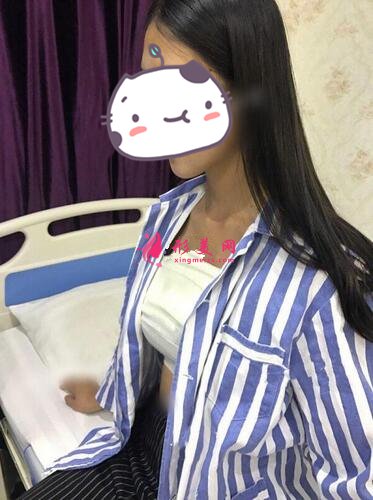 成都怡脂醫(yī)療美容醫(yī)院自體脂肪豐胸案例