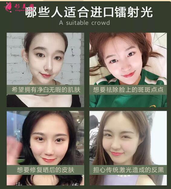 白瓷娃娃美容多少錢?