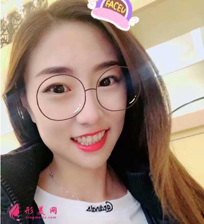 和顏美帕劉喆做白瓷娃娃怎么樣？術(shù)后60天真人案例效果分享~