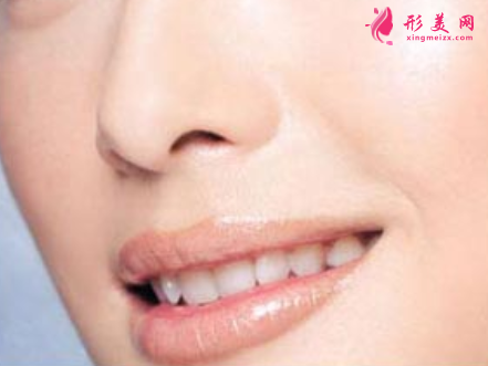 鼻翼縮小手術(shù)什么時(shí)候拆線