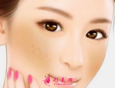 激光祛斑效果可以保持多久