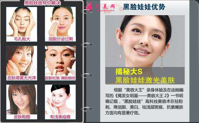 什么是黑臉娃娃？原理和作用可以了解下~