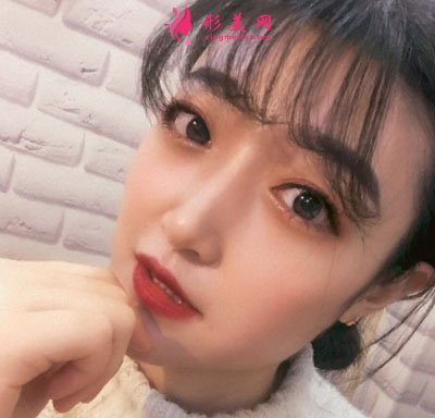 北京畫美瘦臉案例