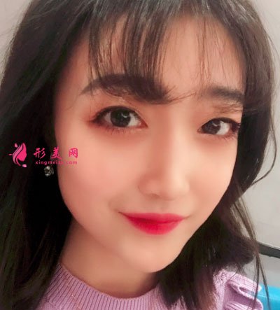 北京畫美瘦臉案例