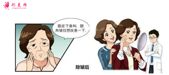 注射除皺效果怎么樣？附術(shù)前術(shù)后注意事項！