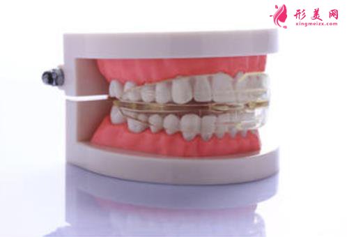 兜齒矯正的最佳年齡是多少歲?別讓兜齒影響孩子的一生!