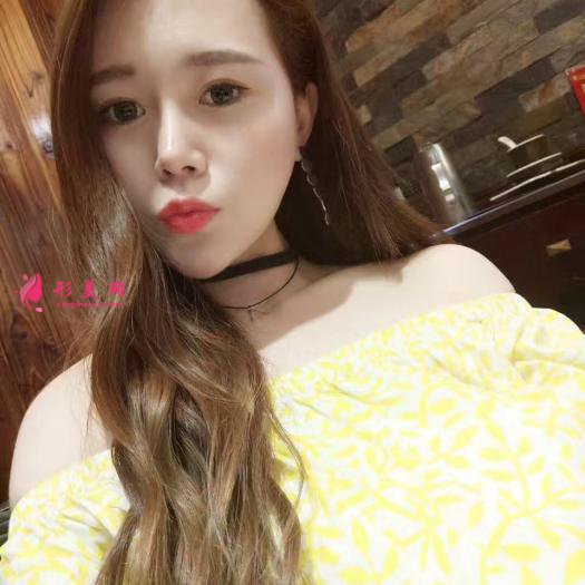 做自體肋軟骨和膨體綜合隆鼻后感受 做自體肋軟骨和膨體綜合隆鼻后感受