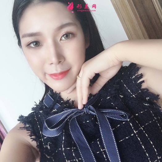 做完超皮秒祛斑效果是超級好 做完超皮秒祛斑效果是超級好