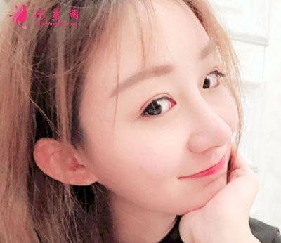 北京美萊醫(yī)療美容醫(yī)院鼻部多項(xiàng)手術(shù)案例
