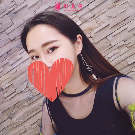 北京八大處楊明勇做雙眼皮修復手術前