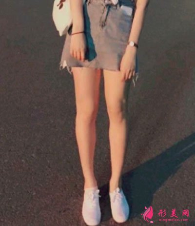 天津維美醫(yī)療美容醫(yī)院做的吸脂瘦大腿