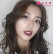 上海第九人民醫(yī)院整形科面部脂肪填充效果咋樣?