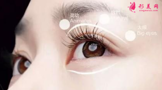 雙眼皮整形價格要多少錢