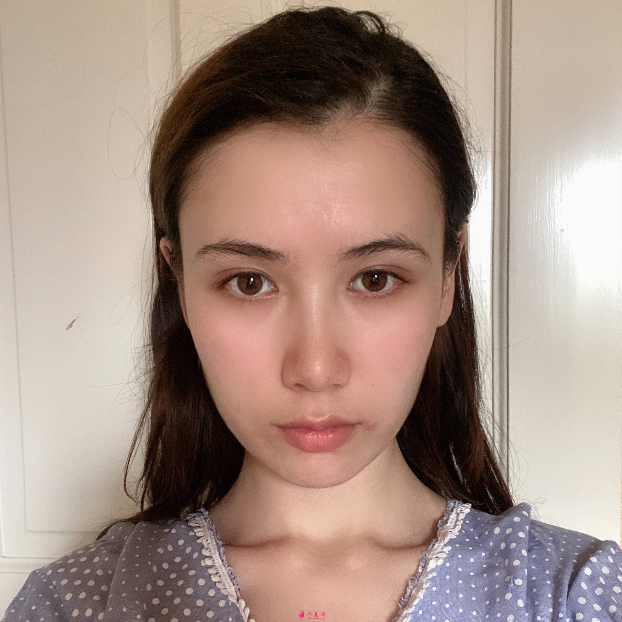 熱瑪吉術(shù)前