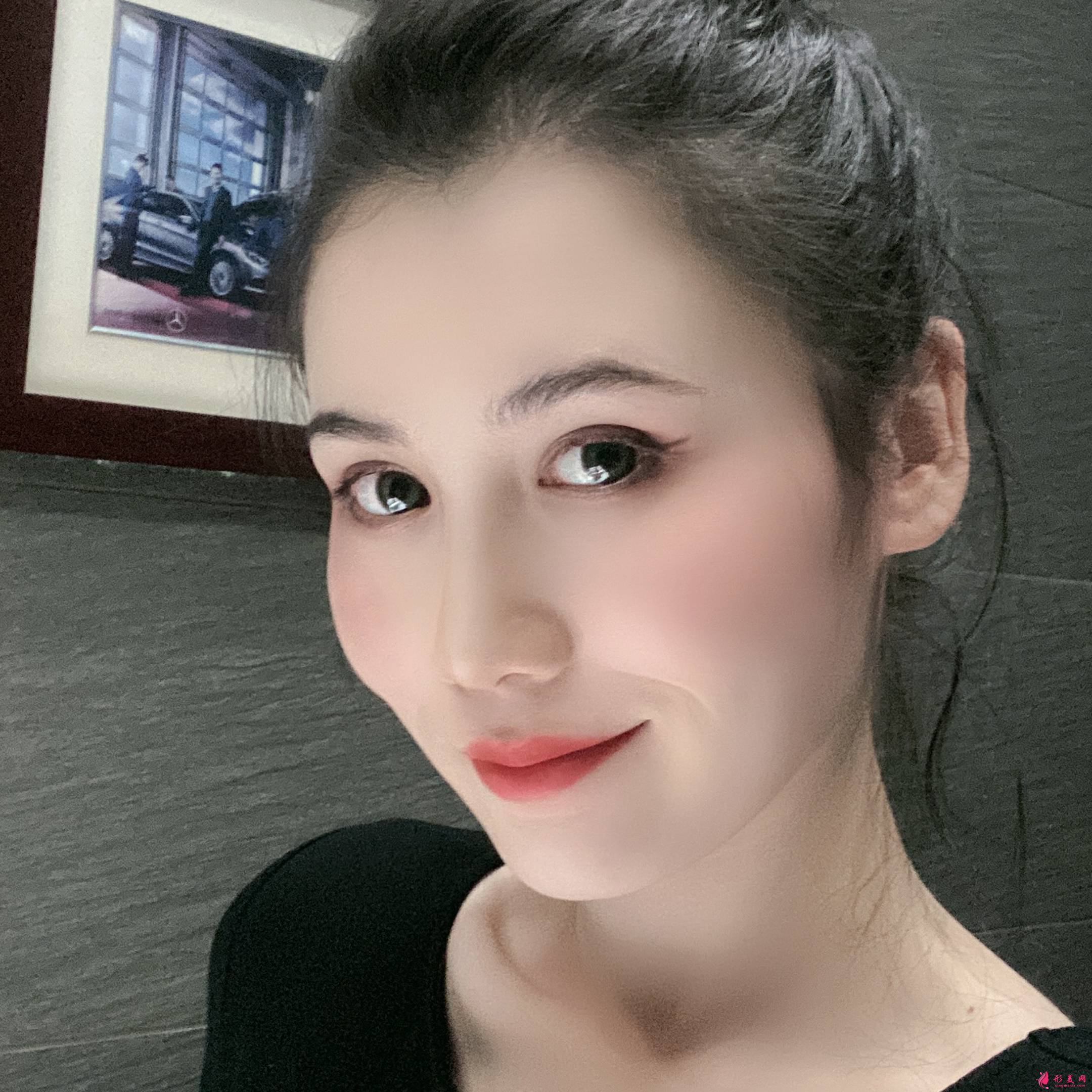 熱瑪吉術(shù)后