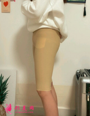 寧波靜港整形美容祝海新案例