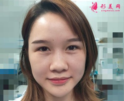 武漢韓辰醫(yī)療美容鼻部多項(xiàng)案例 