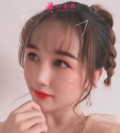 武漢韓辰醫(yī)療美容鼻部多項(xiàng)案例 