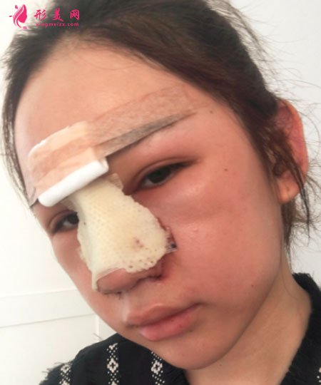 武漢韓辰醫(yī)療美容鼻部多項(xiàng)案例 