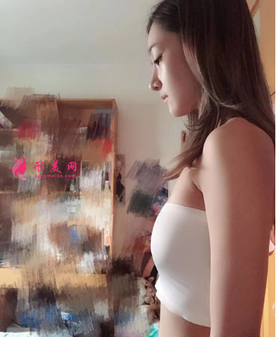 武漢藝星雷云飛假體隆胸