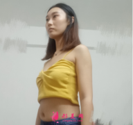 重慶美圣美邦任志偉做腰腹吸脂，還你一個迷人小蠻腰哦~