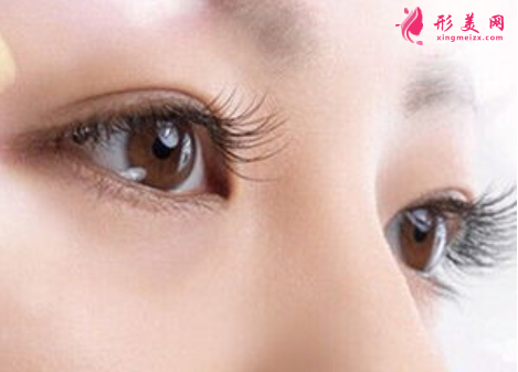 廣州美萊雙眼皮整形好嗎